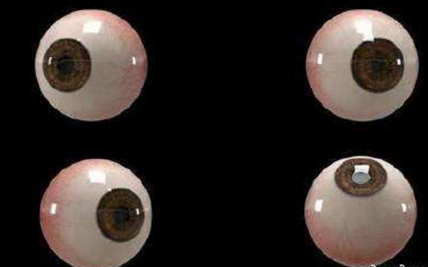 世界首個(gè)3D人工眼球問(wèn)世，數百萬(wàn)人將重見(jiàn)光明